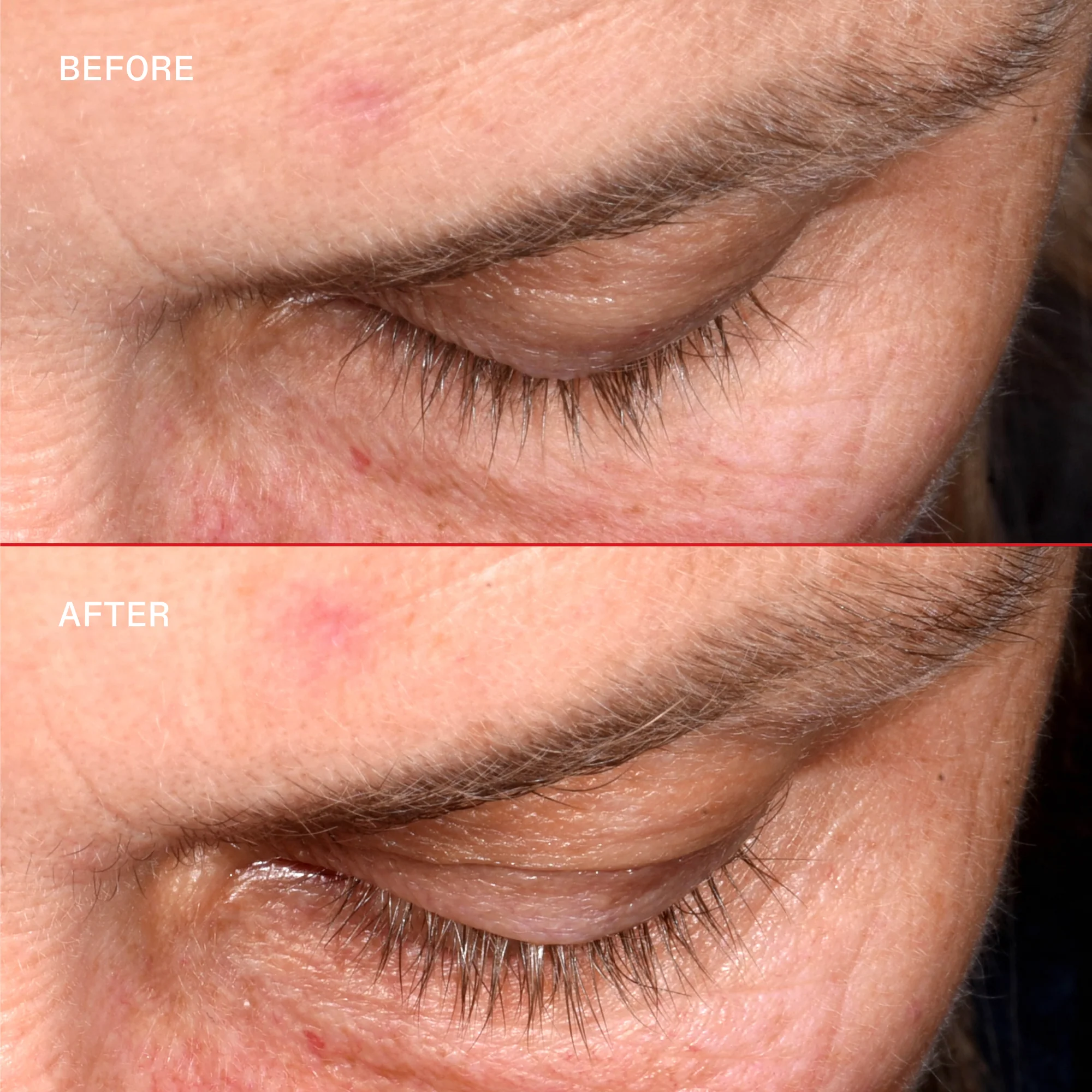 LASHBOND™ skropstu veidošanas serums — skropstu kopšana