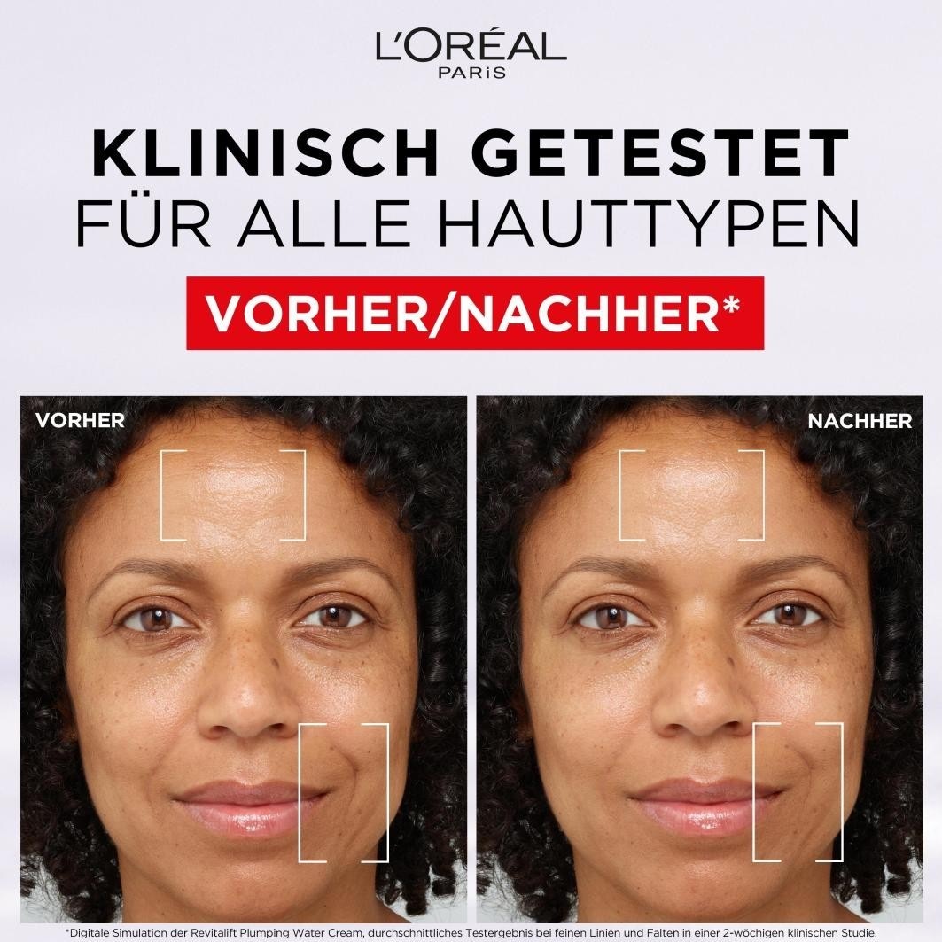 Filler Gel-Creme