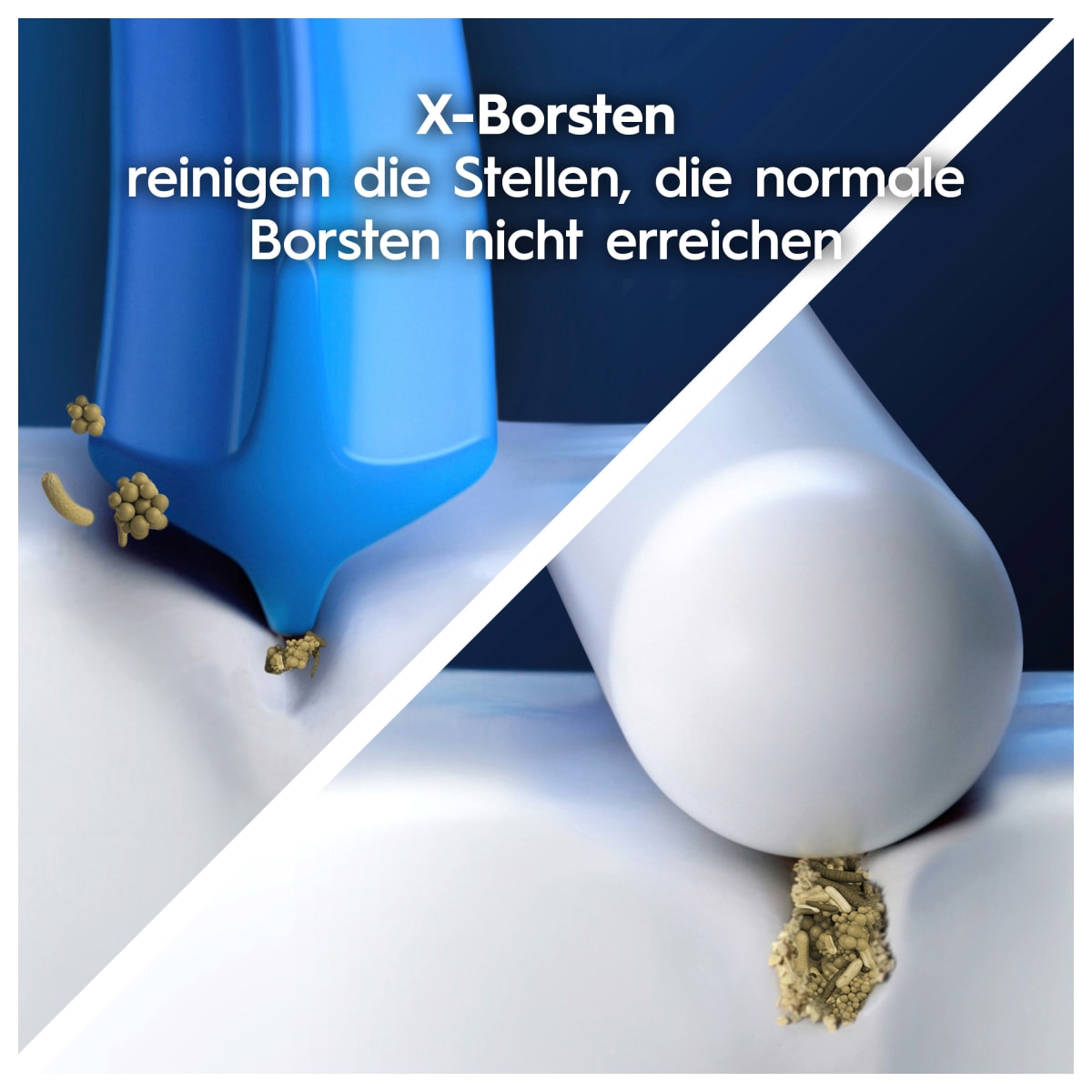 Aufsteckbürsten PRO Sensitive, 4 St