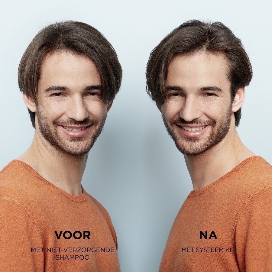 Kuracja Nioxin Scalp & Hair do włosów farbowanych i lekko przerzedzających się