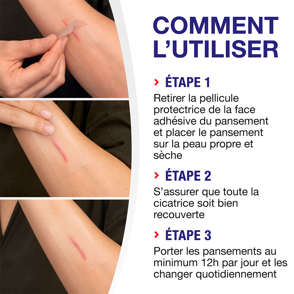 elastoplast Elastoplast Réducteur de Cicatrices - BoBoîte de 21 pansements Pansements réducteurs de cicatrices