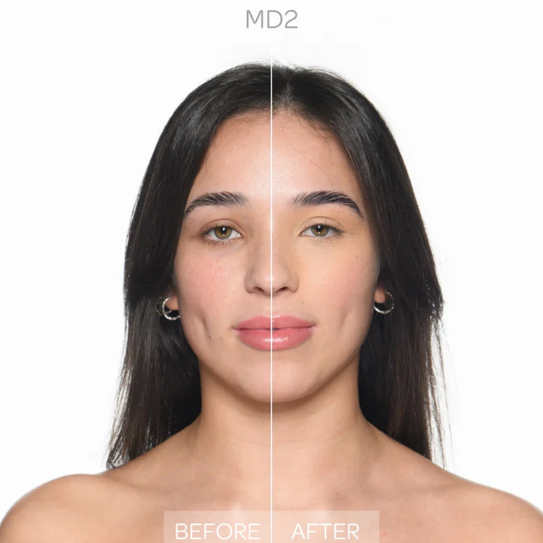 Corrector de impacto facial