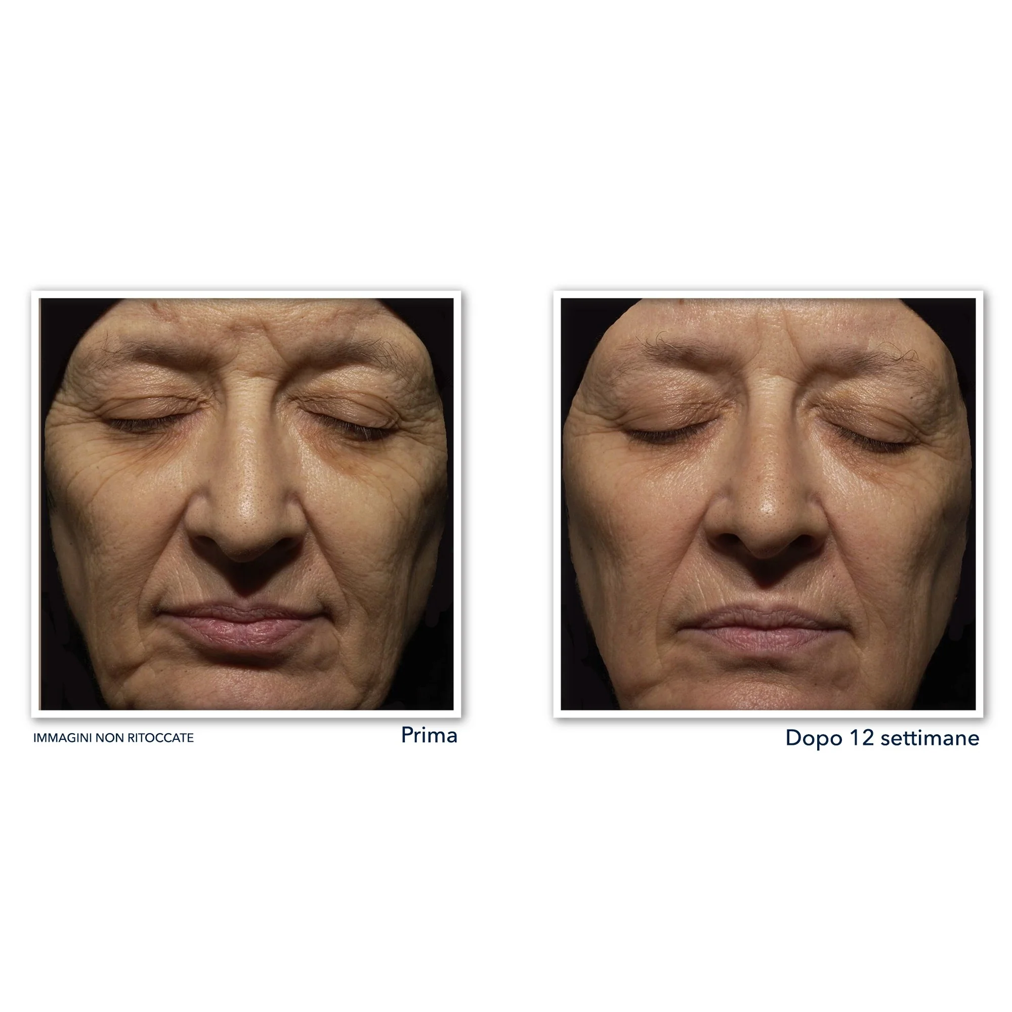 Crema de noche antiarrugas Retinol Correxion - Tratamiento nocturno antiarrugas