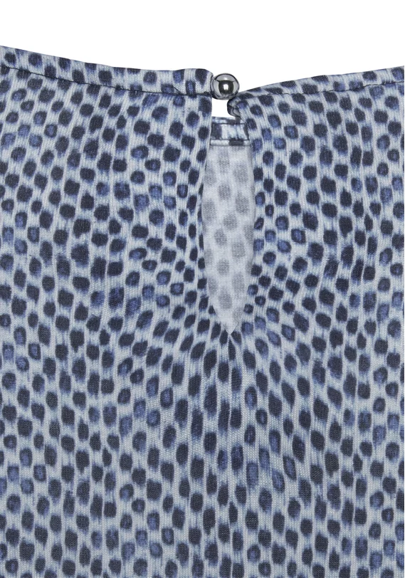 Shirttop