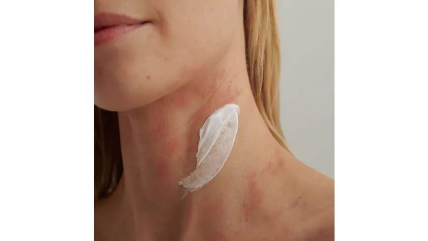 DADO SENS EXTRODERM Intensivcreme - bei  trockener Haut und Neurodermitis 50 ml