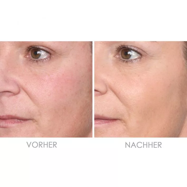VITAMIN E hautglättendes Serum