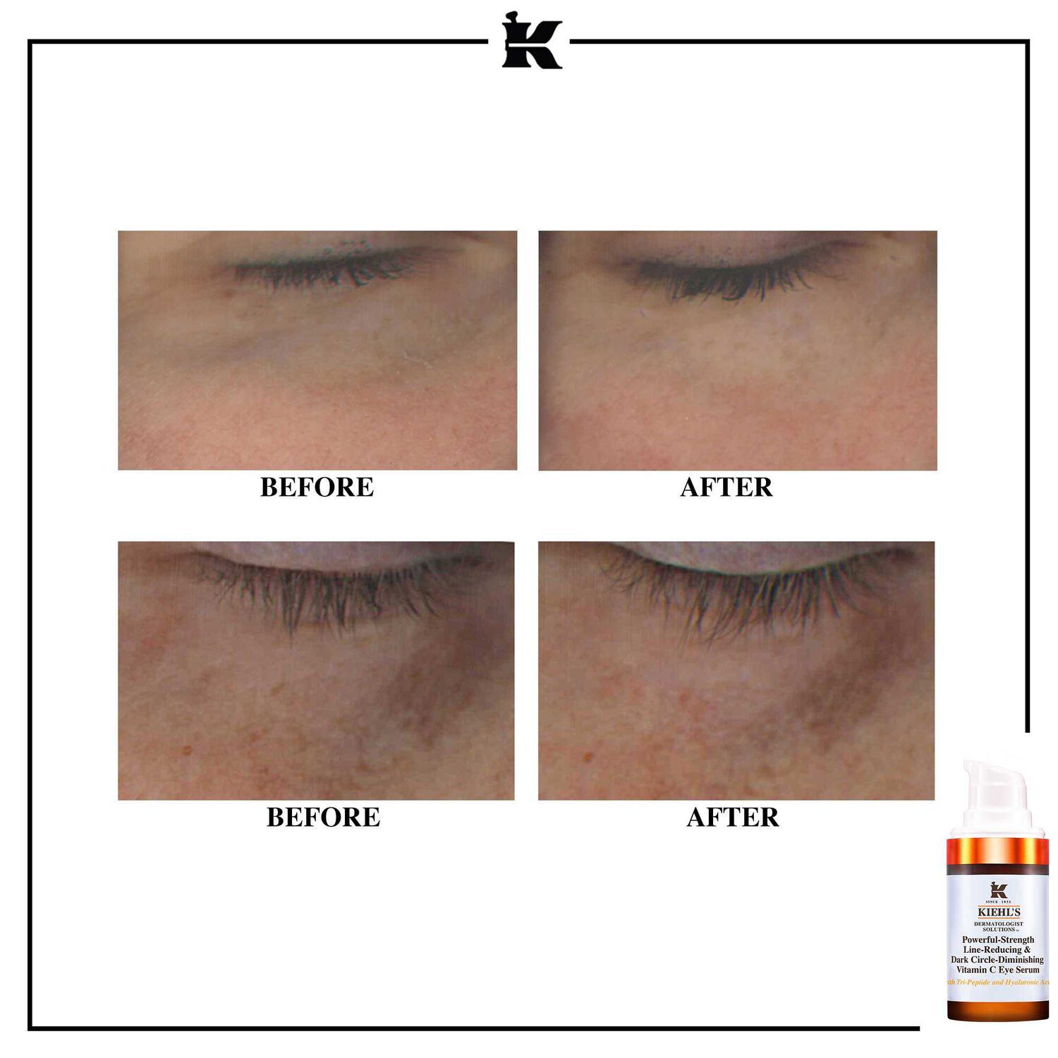 kiehl's Powerful-Strength Line-Reducing & Dark Circle-Diminishing Vitamin C Sérum Contour des yeux et anti-cernes à la vitamine C 15 ml