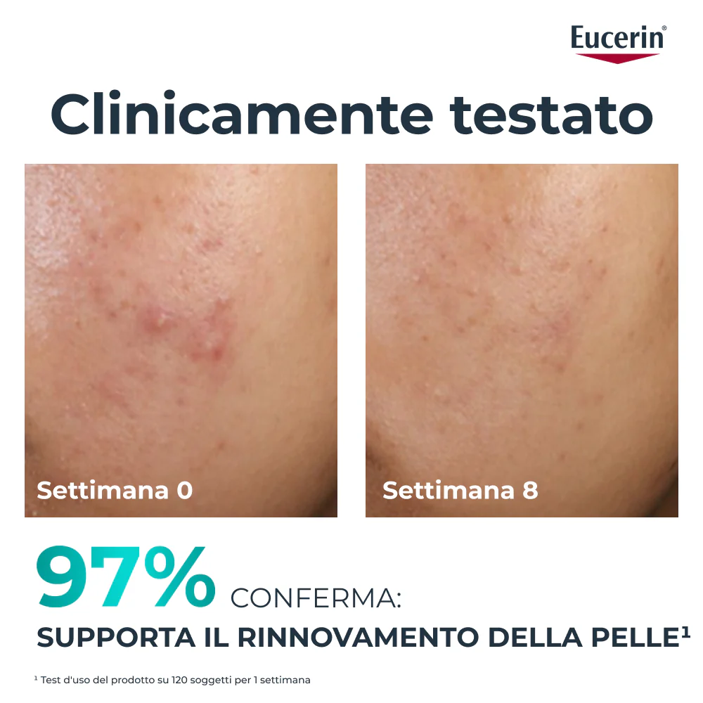 Dermopure Renewing Treatment - sérum proti nedokonalostiam pleti, 24-hodinová starostlivosť proti nedokonalostiam pleti