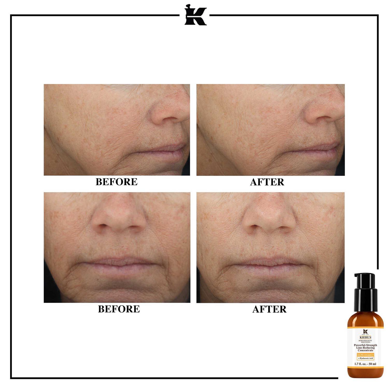 kiehl's Powerful-Strength Line-Reducing Concentrate Sérum puissant réducteur de rides à la vitamine C