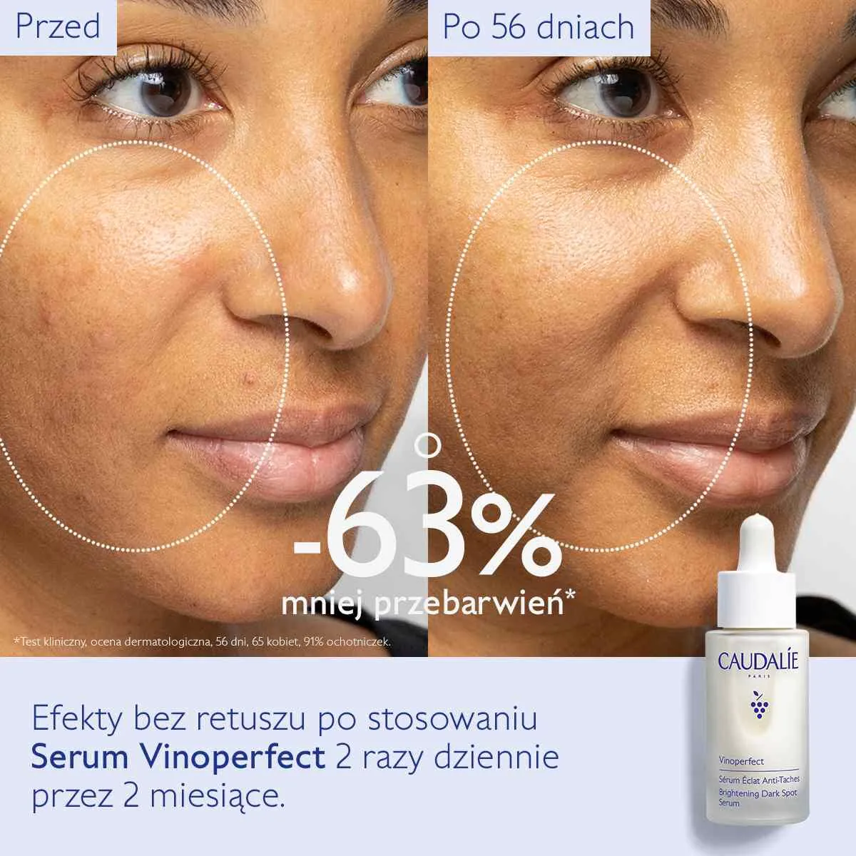 Caudalie Vinoperfect Ορός Λάμψης για Αποχρωματισμό