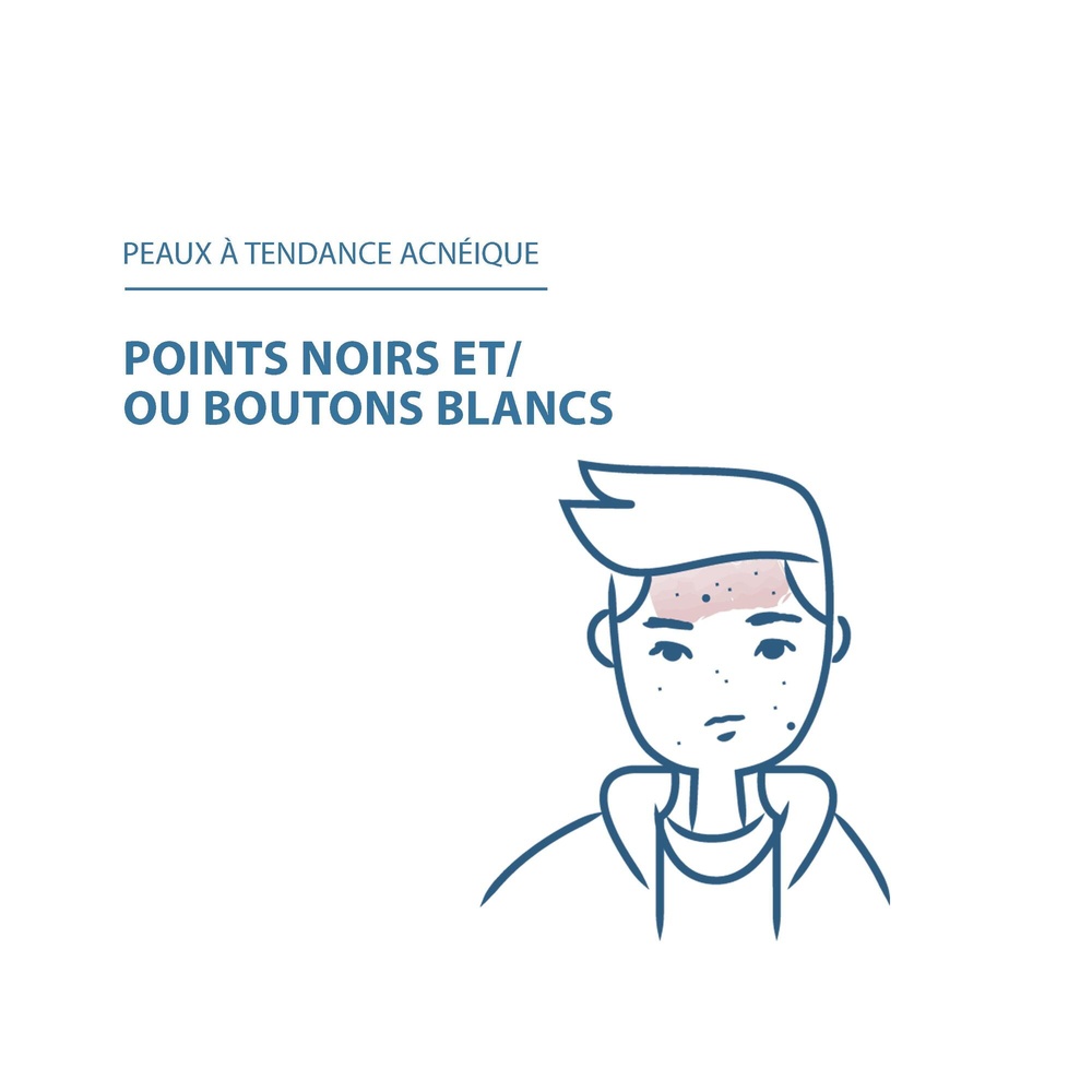 Ducray Keracnyl - Glycolic Emulsion points noir s et  imperfections Soin visage