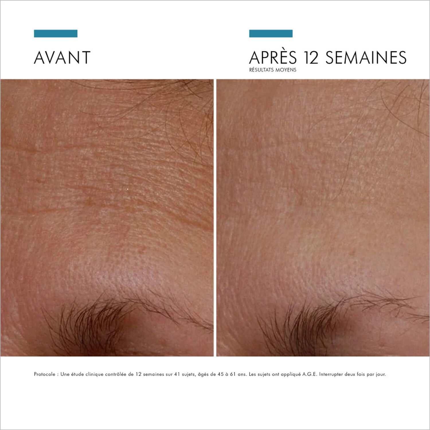 Skinceuticals A.G.E. Interrupter Soin Anti-Rides & Fermeté 48 ml