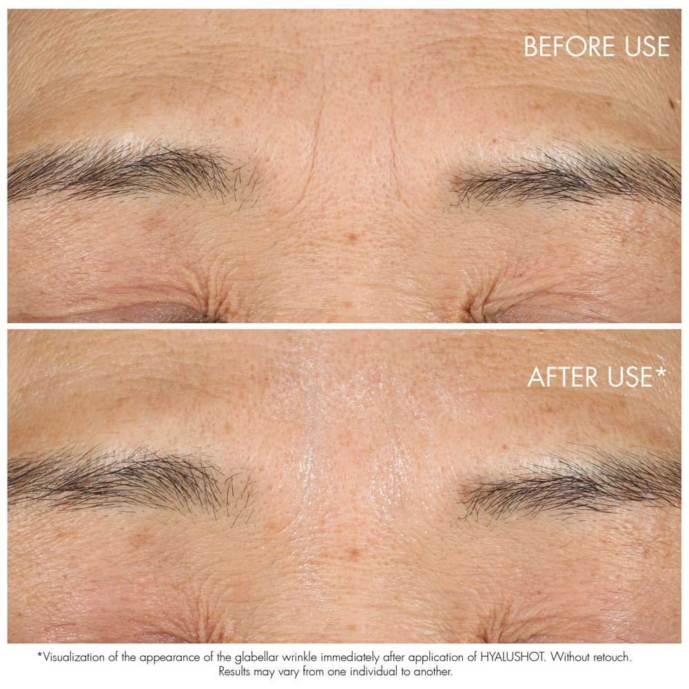 DIOR CAPTURE TOTALE HYALUSHOT