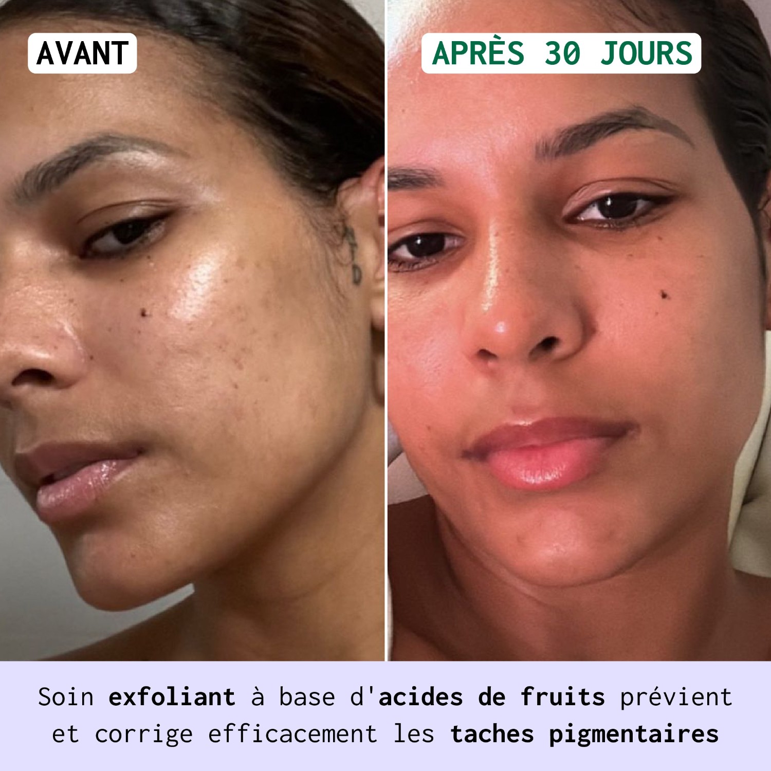 Nubiance HRB-3 serum protiv tamnih mrlja