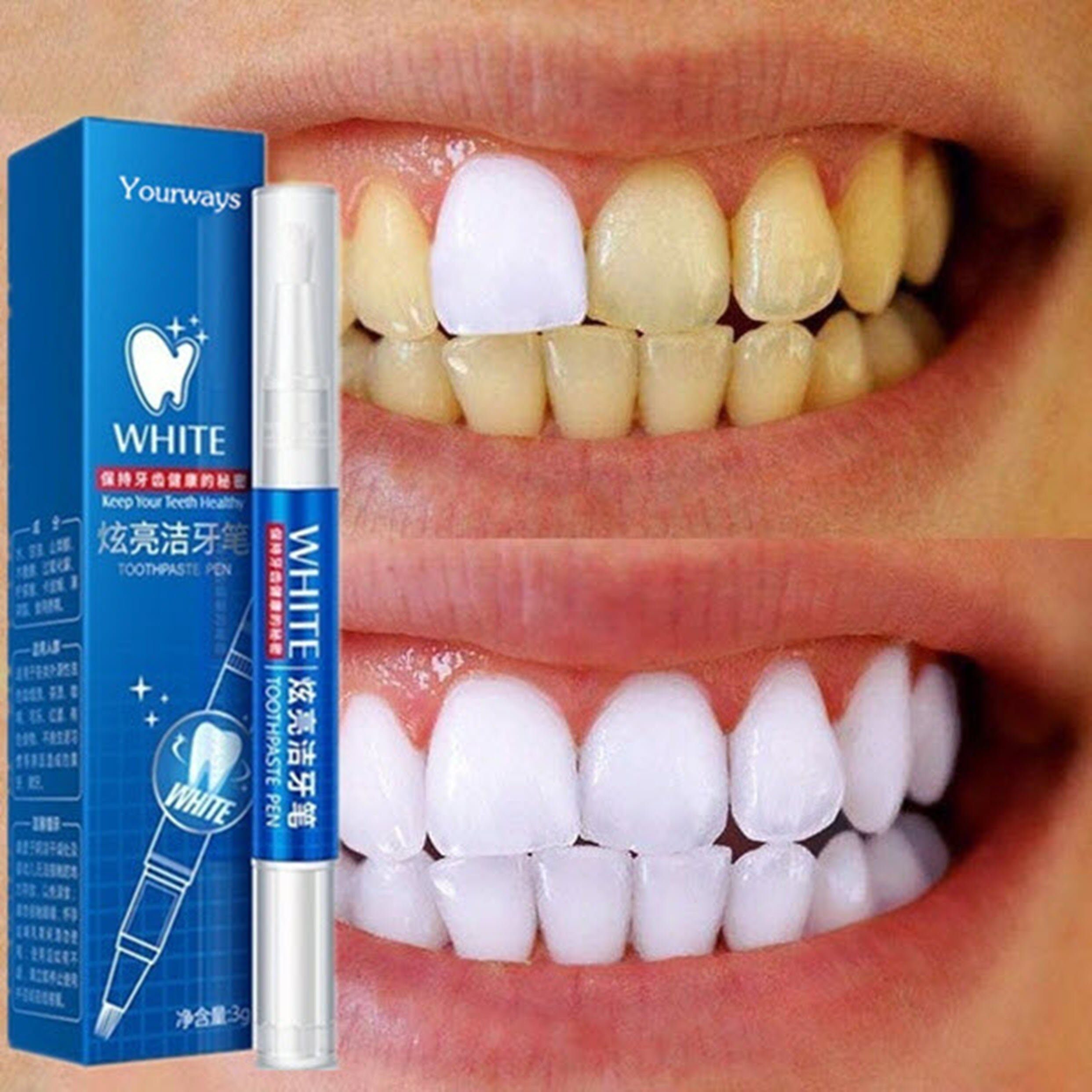 Spectrum Zahnbleaching-Paste 2 x 1,8 ml Absolut Whitening Gelstift weisse Zähne Bleeching