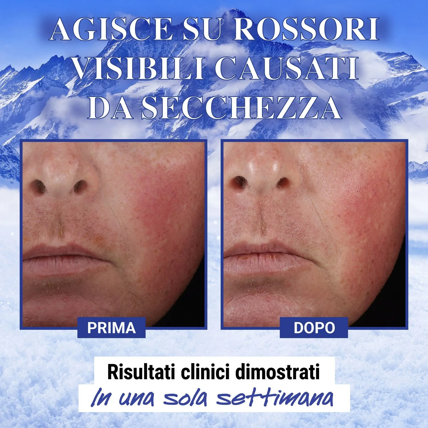 Ultra Facial Advanced Repair Barrier Cream - Reparerende behandling, 24-timers fuktighetsgivende ansiktsbehandling, 24-timers lindrende ansiktsbehandling