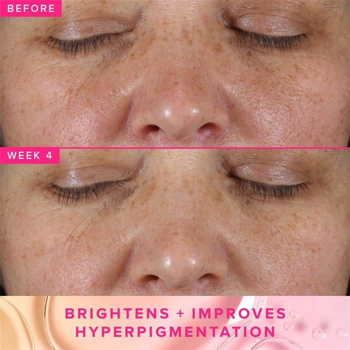 Brighten Up 3% TXA Dark Spot Toner