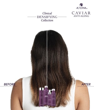 ALTERNA CAVIAR Clinical Densifying Scalp Treatment Haarserum-125 ml