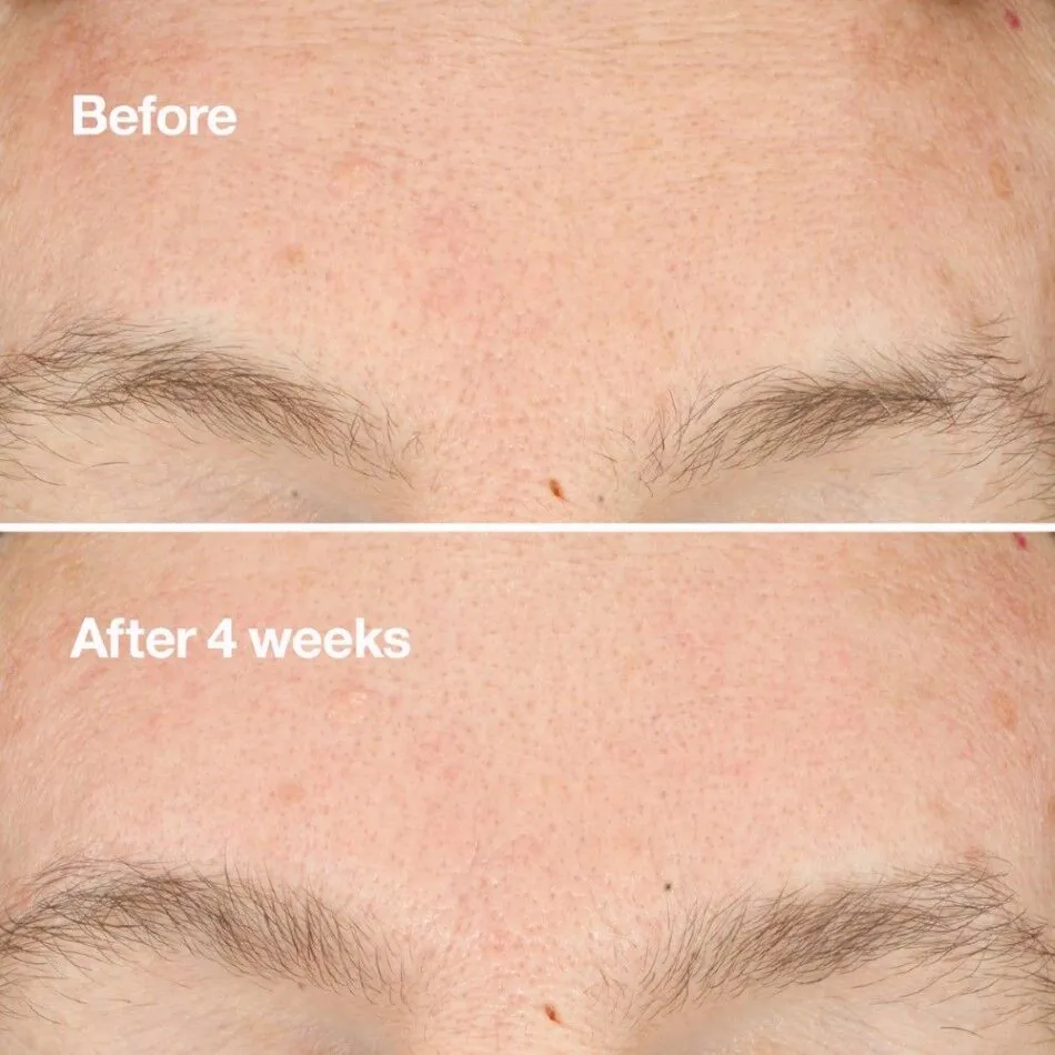 Clinique Clarifying Do-Over Peel Piling za lice