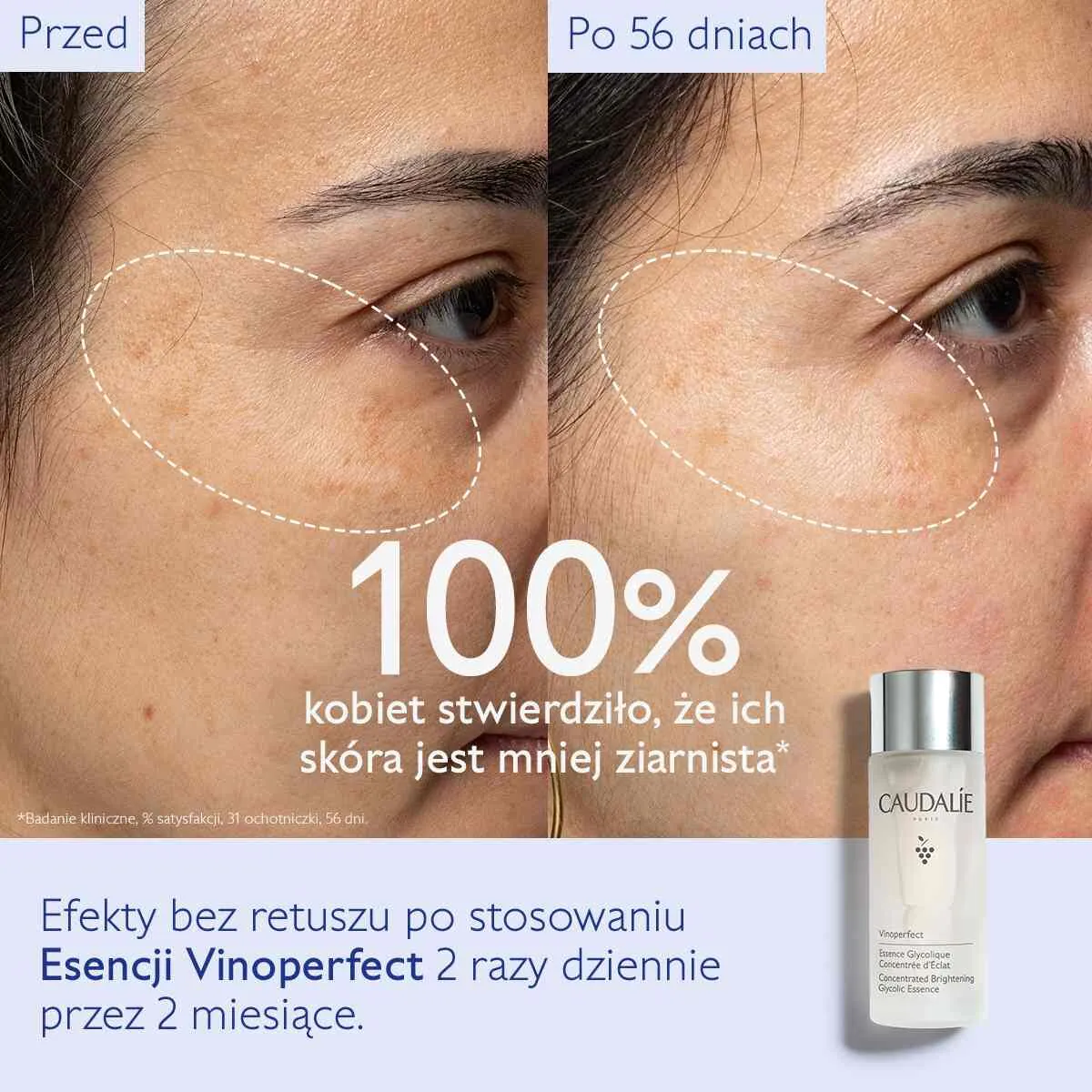 Caudalie Vinoperfect концентрована гликолна есенција за блиставост