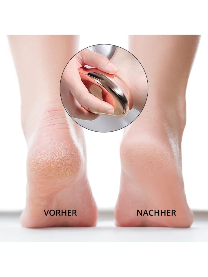 Ailoria DOUCETTE PRO Hornhautentferner in rot günstig kaufen onesize