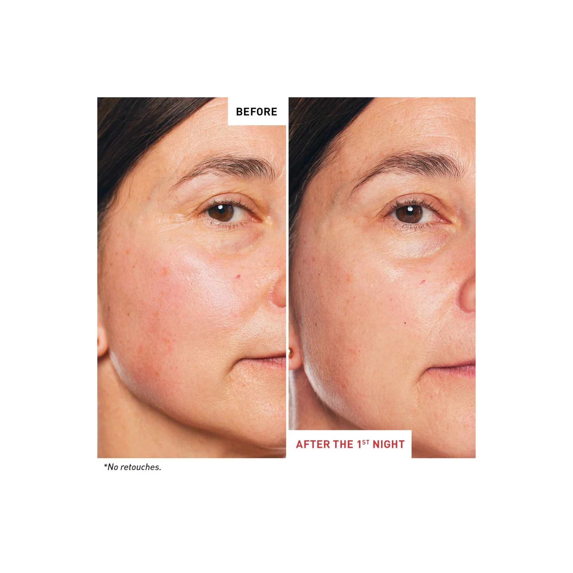 Super Ingredients Skin Therapy Nachtöl – Gesichtsöl mit globaler Wirkung, umfassende Gesichtspflege für die Nacht