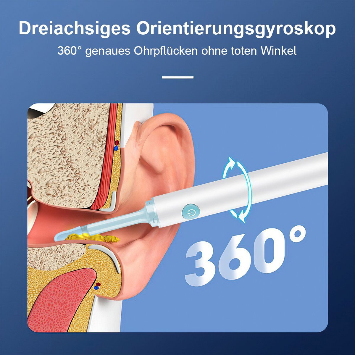 Welikera Ohrenreiniger Ohrenschmalz-Entfernungswerkzeug, HD led Wasserdicht Ohrenreiniger