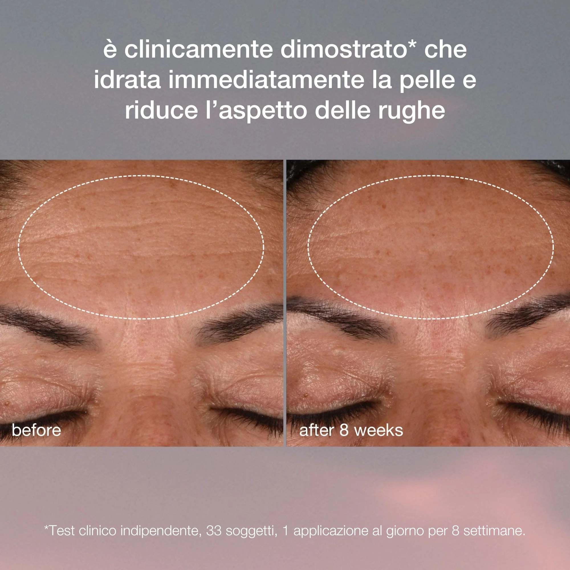 Dynamic Skin Recovery SPF50 - Anti-wrinkle day cream, Protective Treatments