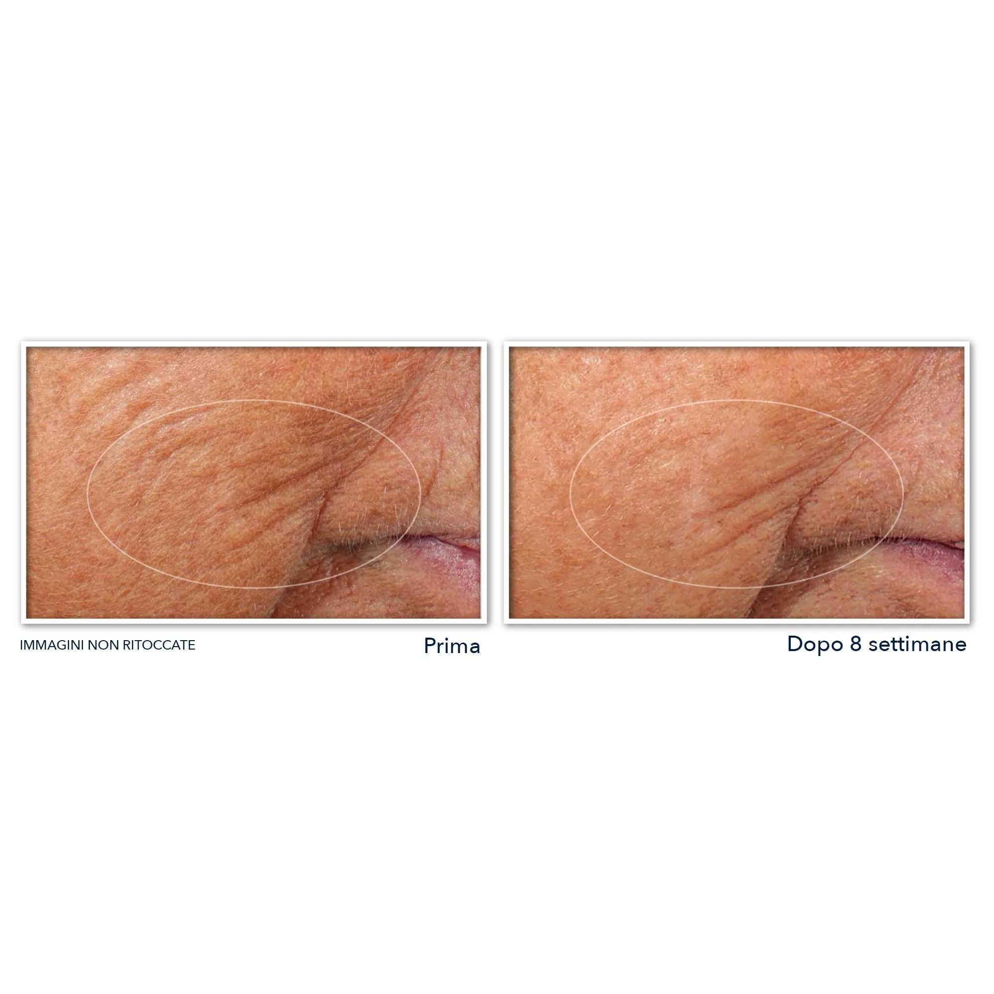 Retinol Correxion Line Smoothing noćni serum za lice u kapsulama - Noćni tretman protiv bora, Serum za lice protiv bora