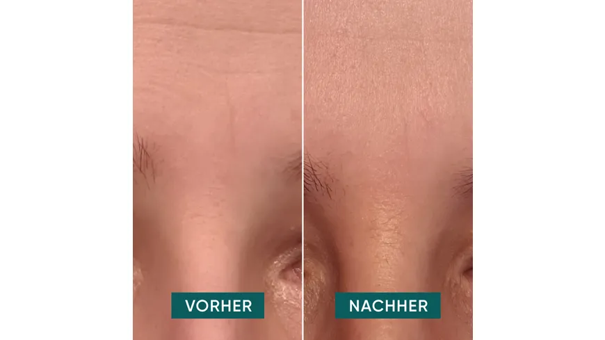 APRICOT Hyaluron Facial Pads