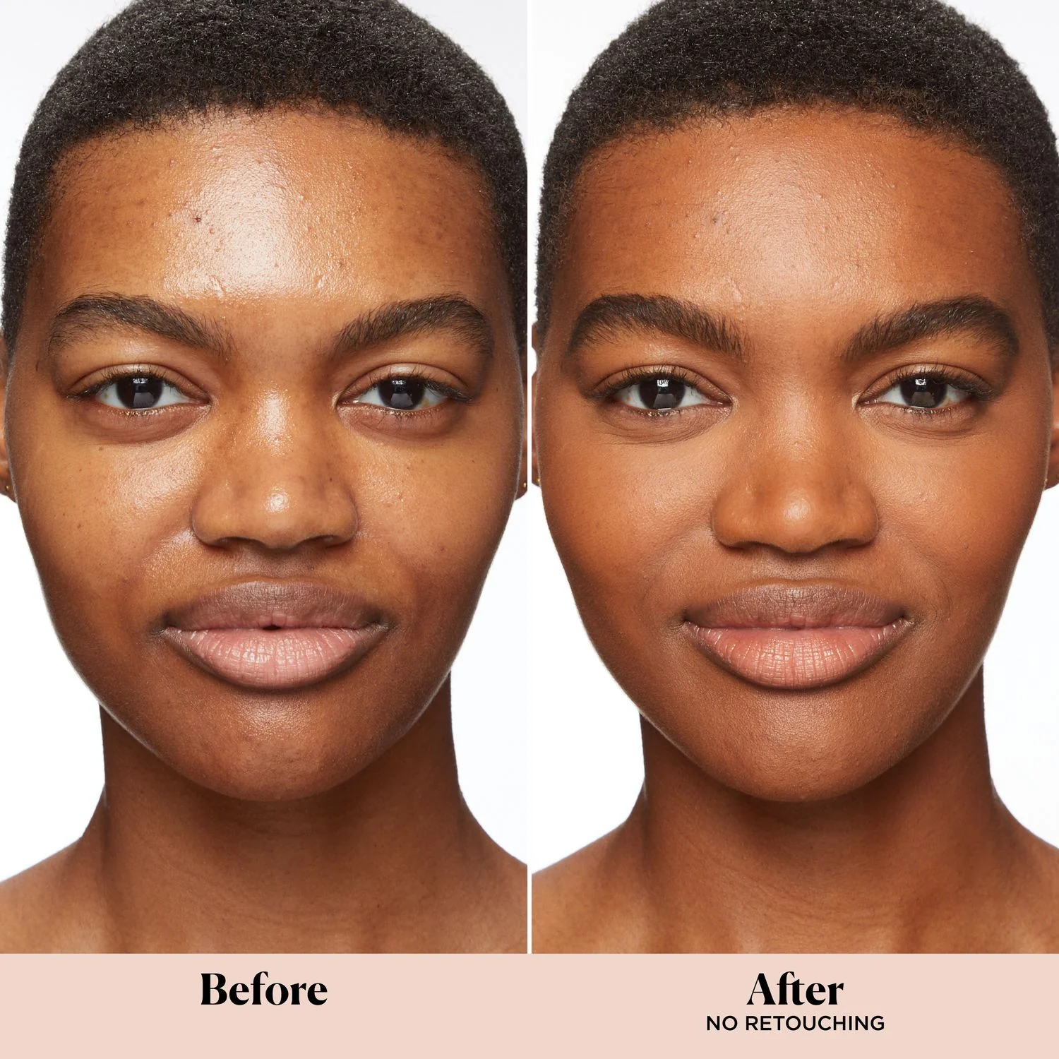 Getinte hydraterende olievrije foundation SPF20 - Crème foundation, getinte gezichtscrème ter voorkoming van onzuiverheden