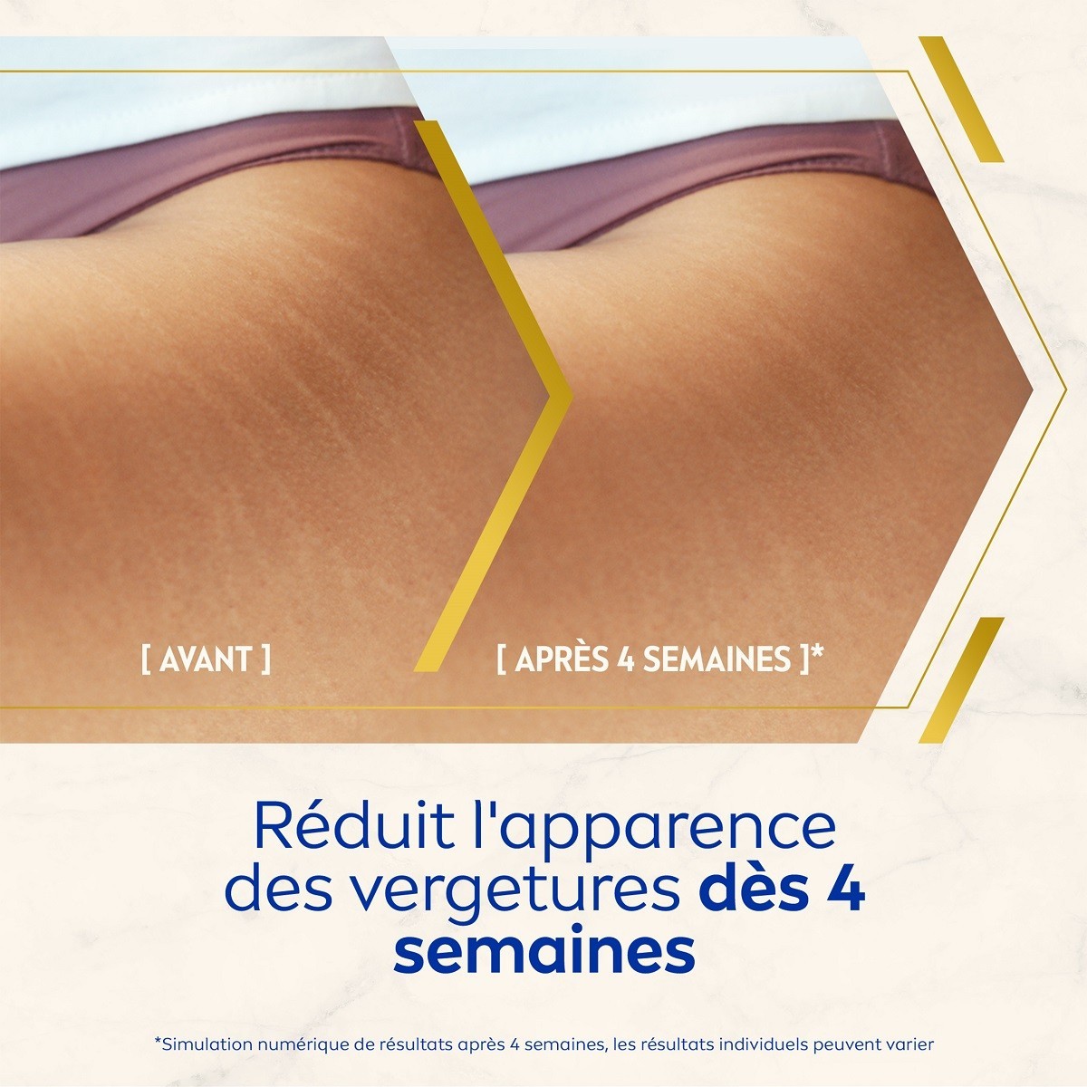 NIVEA Luminous 630 - Kūno serumas nuo strijų, aliejus