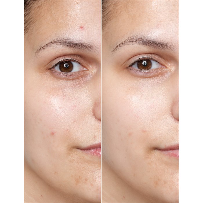 Retinol Power Serum Ampoules
