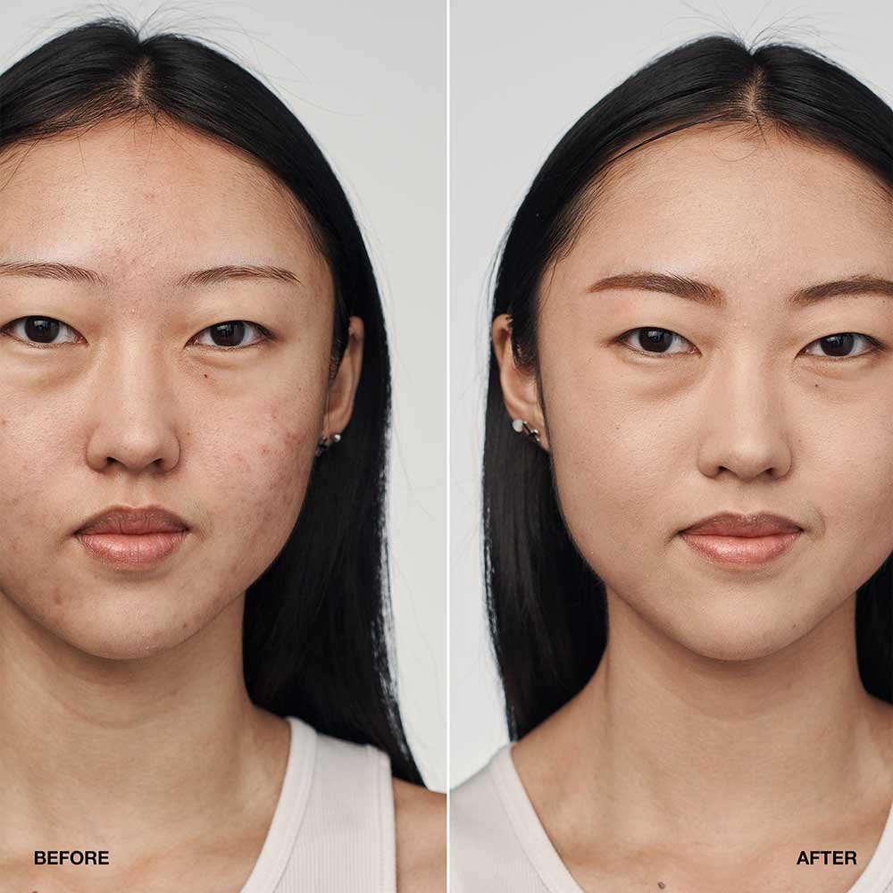 Clinique Foundation Even Better Clinical Serum Foundation SPF20