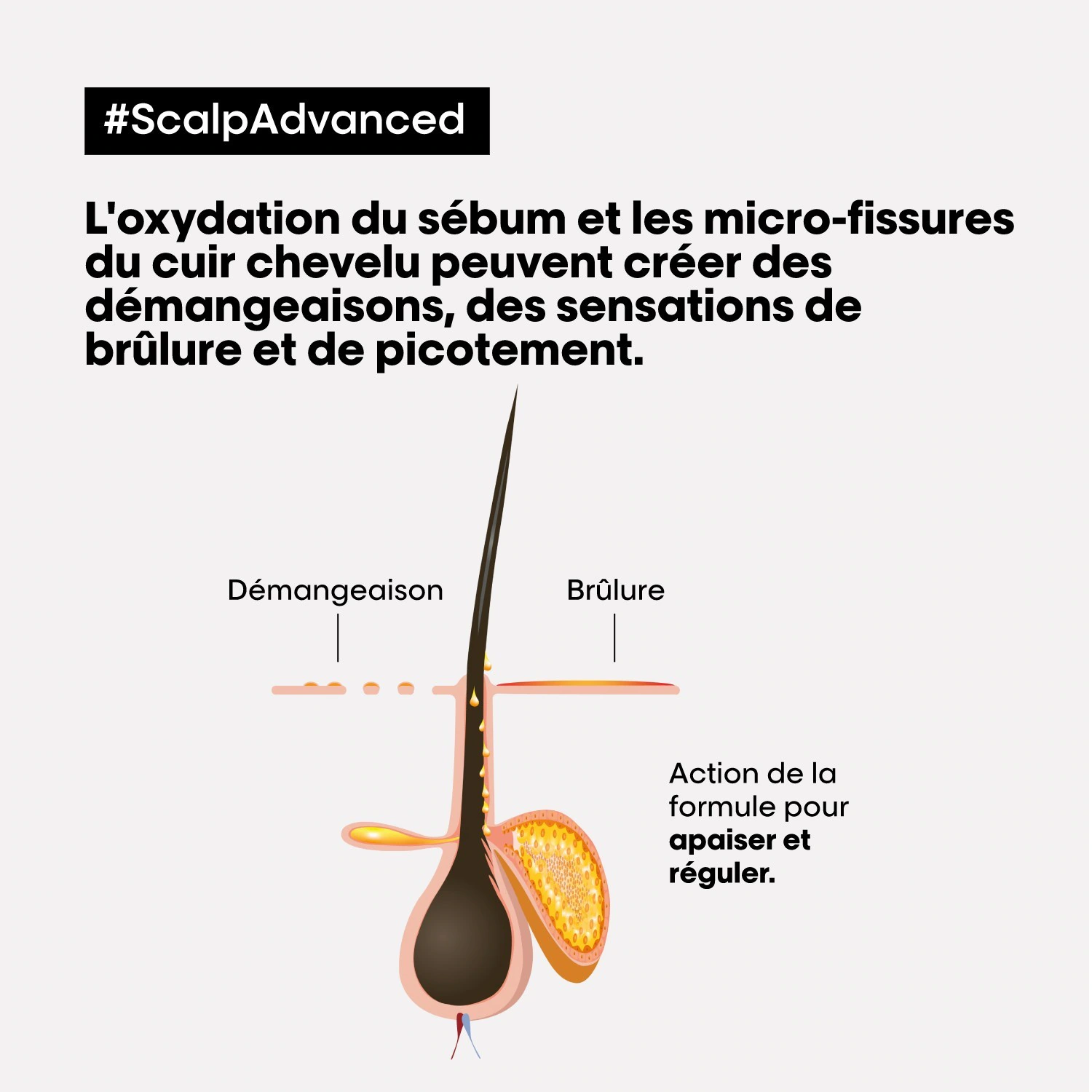 L´Oréal Professionnel Paris Scalp Advanced
