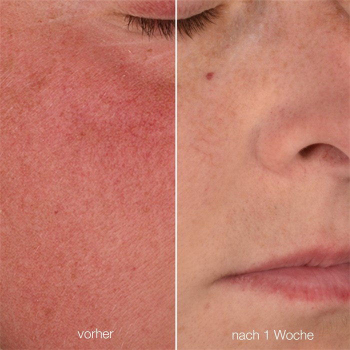 Stabilizing Repair Cream