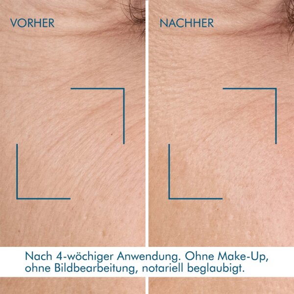Biotherm Blue Retinol Night Serum Gesichtsserum