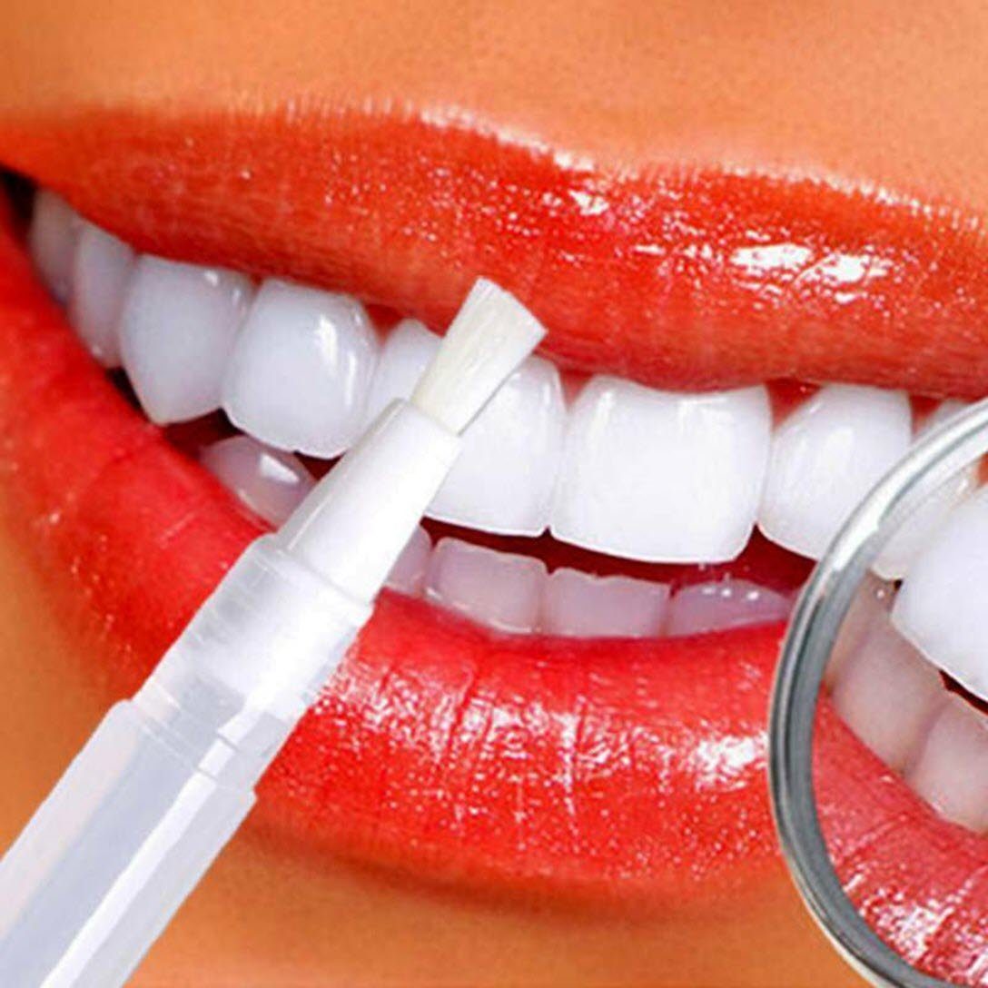 Spectrum Zahnbleaching-Paste 2 x 1,8 ml Absolut Whitening Gelstift weisse Zähne Bleeching