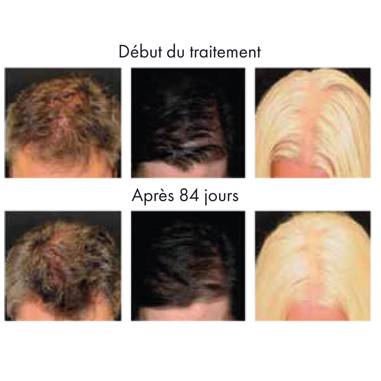 Biokap Lotion wzmacniający