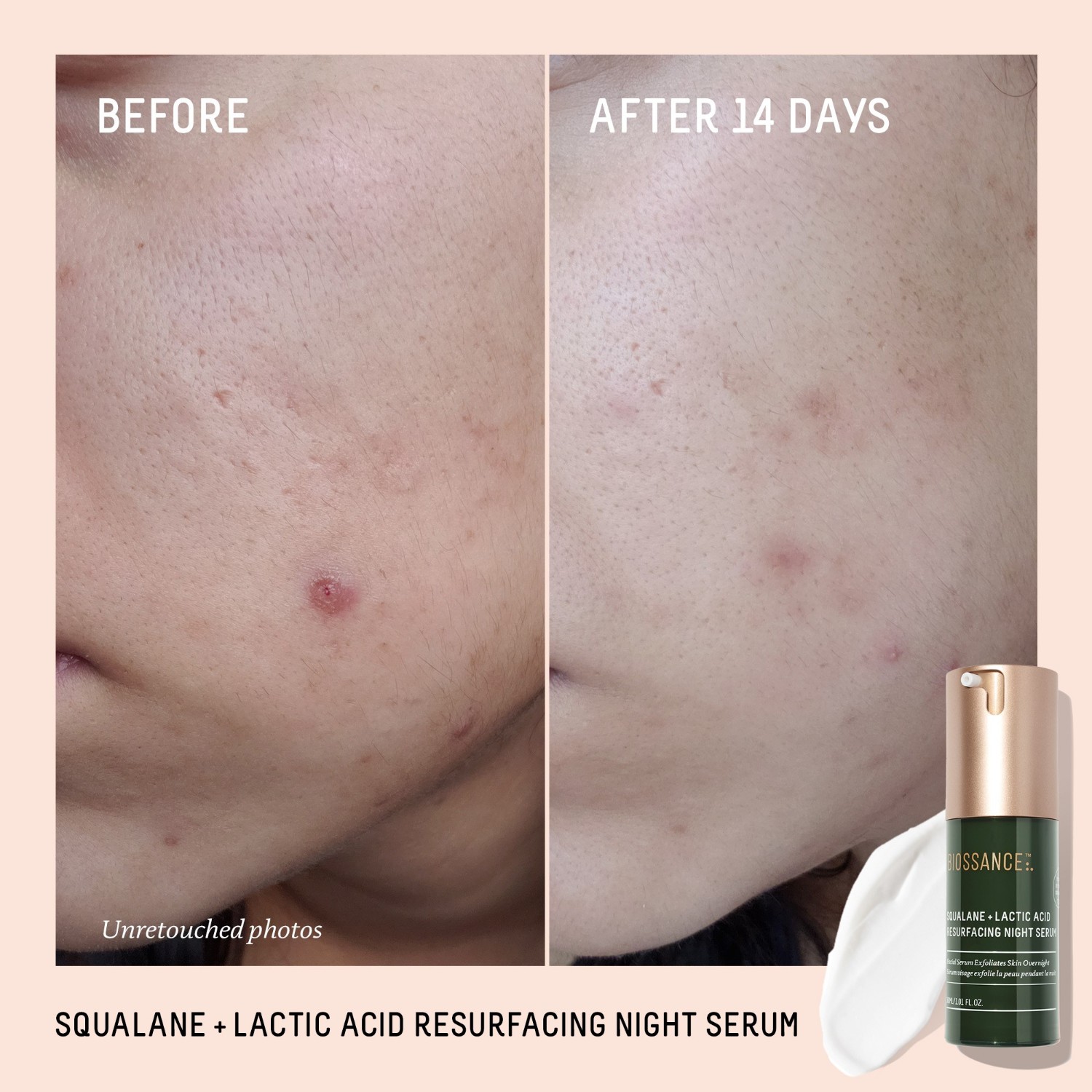 Squalane + Lactic Acid Resurfacing Serum