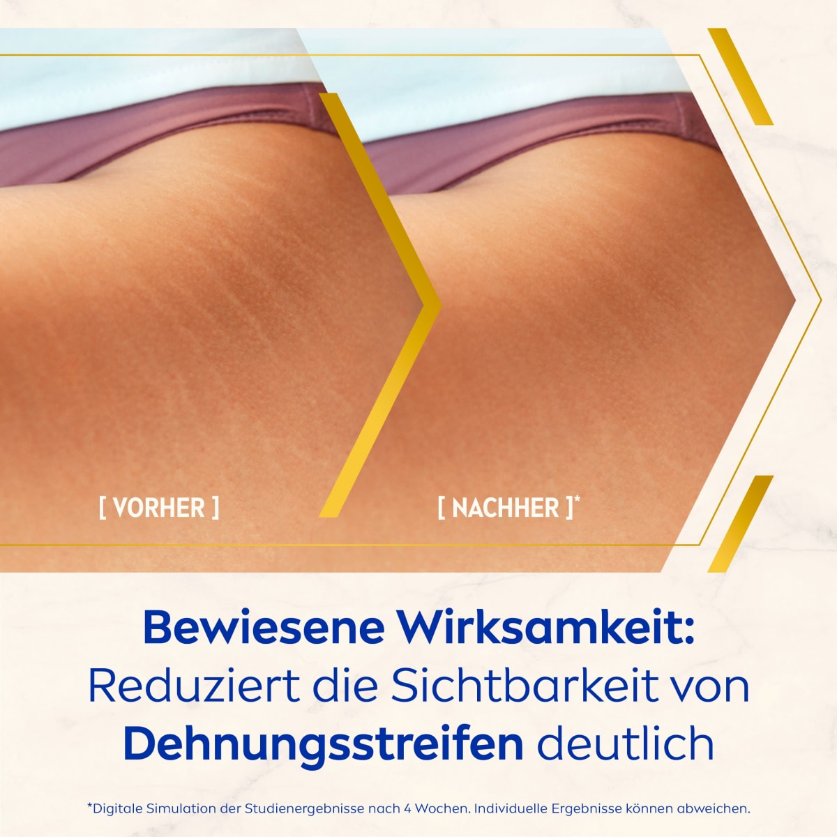 Körperöl Luminous Anti-Dehnungsstreifen, 100 ml