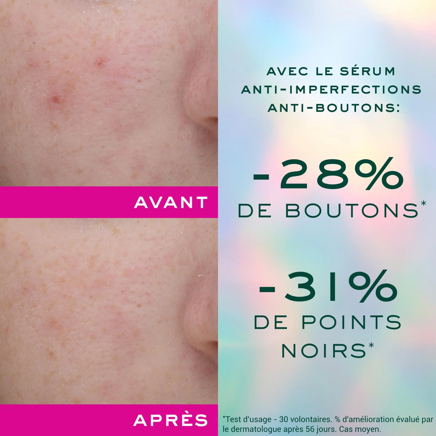 NUXE Anti-Blemish Anti-Blemish Serum