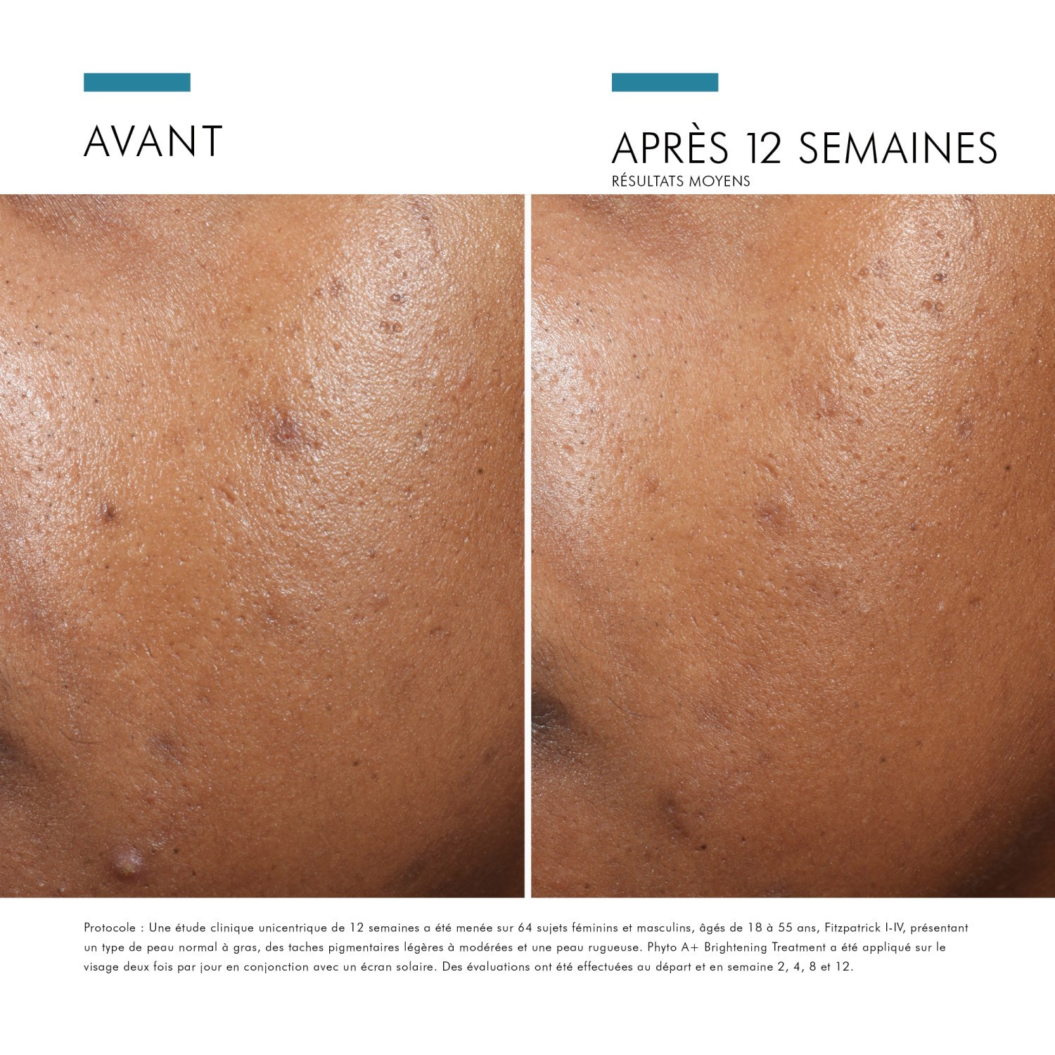 SkinCeuticals PHYTO CORRECTIVE