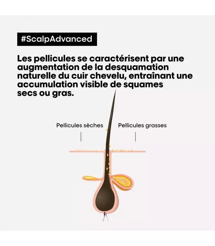 SHAMPOING SCALP ADVANCED ANTI-PELLICULAIRE Scalp Advanced