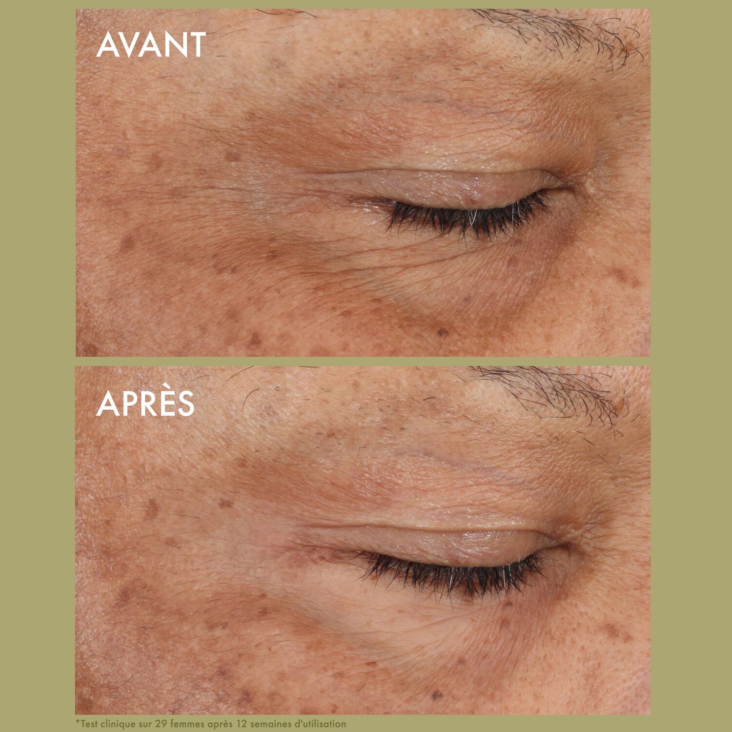 Origins Plantscription™ Crème Yeux Correction Rides au Rétinol Encapsulé