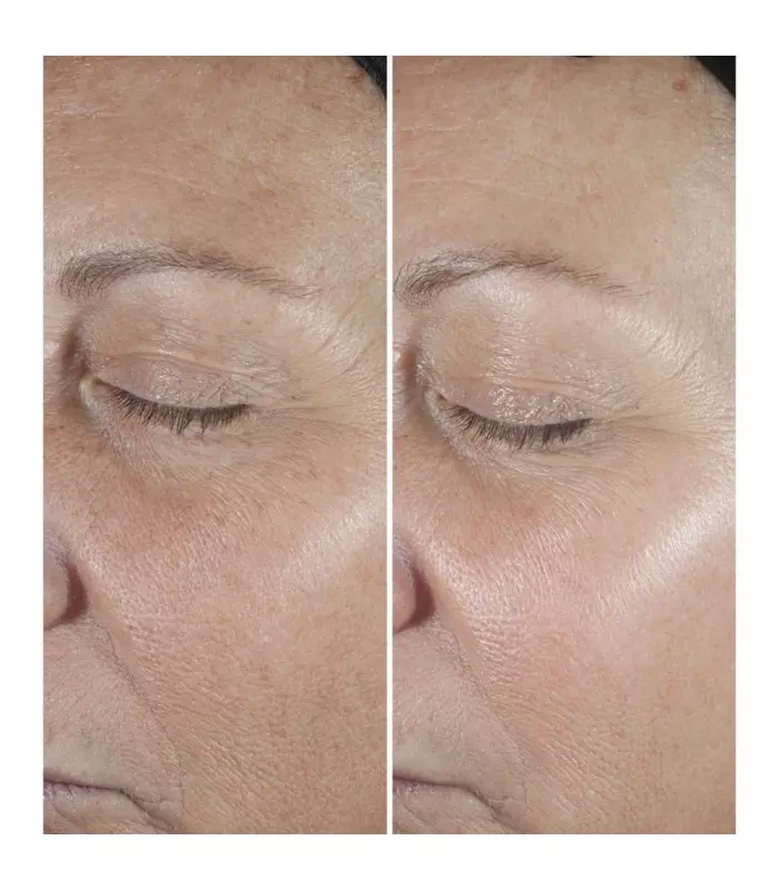 CLINIQUE SMART Clinique Smart Clinical Repair - Sérum Correcteur Anti-rides