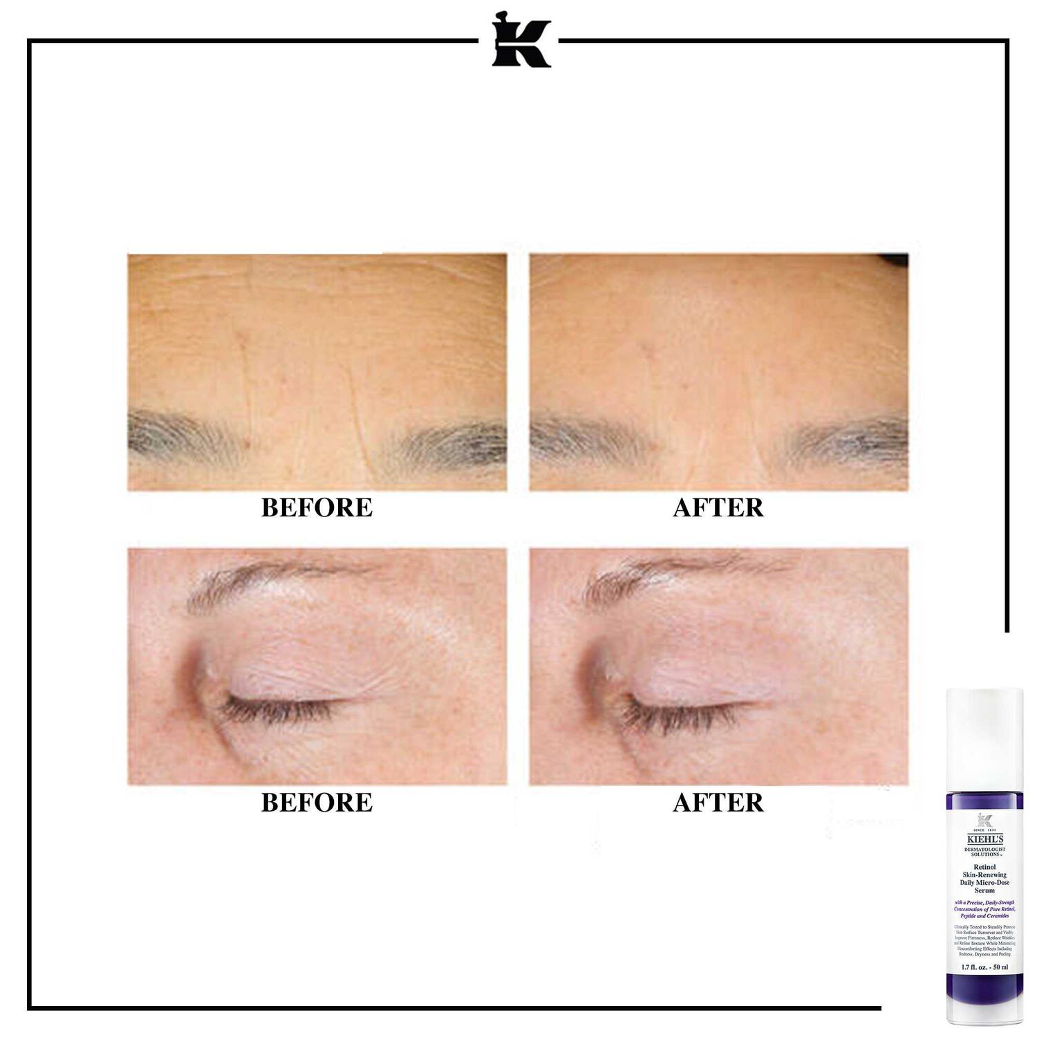 kiehl's Retinol Skin-Renewing Daily Micro-Dose Serum Sérum anti-âge quotidien au rétinol micro-dosé