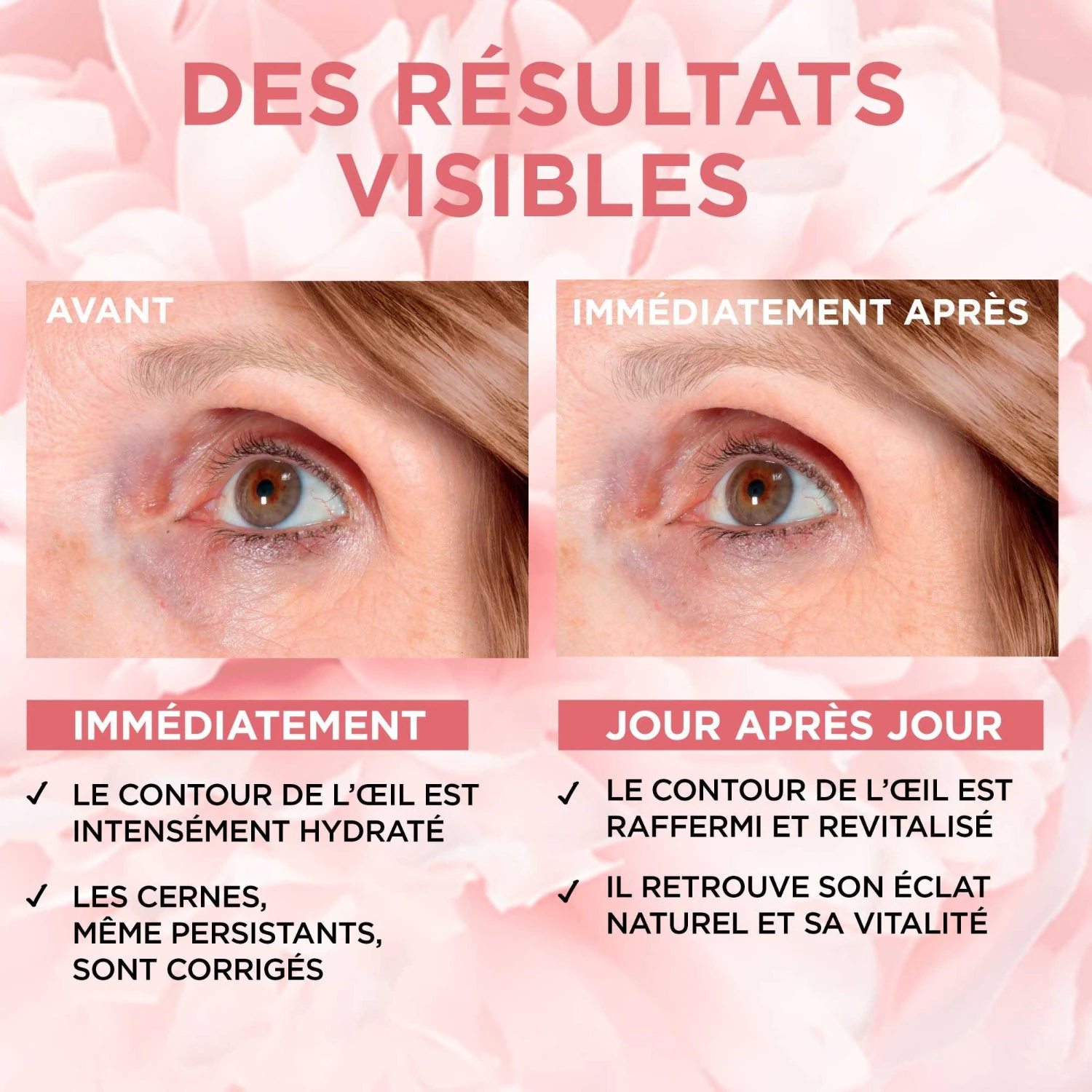 L'Oréal Paris Golden Age Eye Care Rosy Radiance
