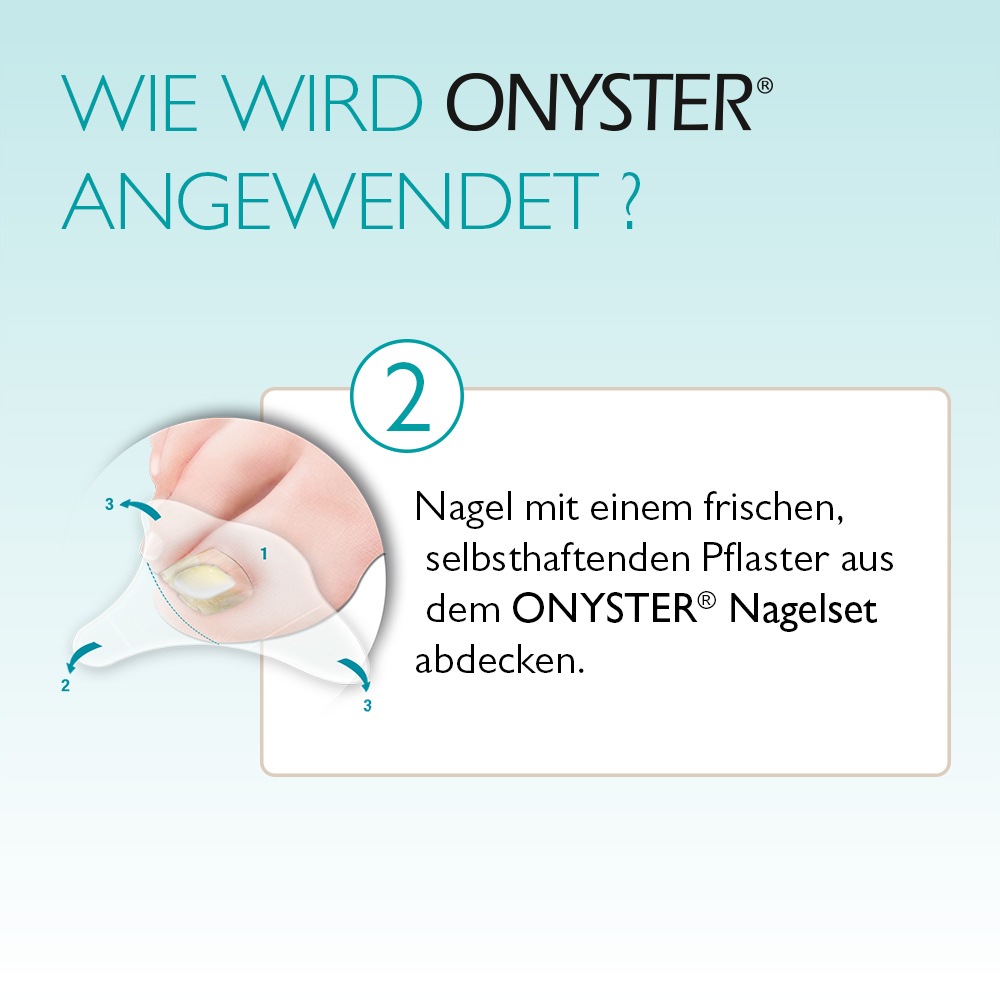 ONYSTER Nagelset