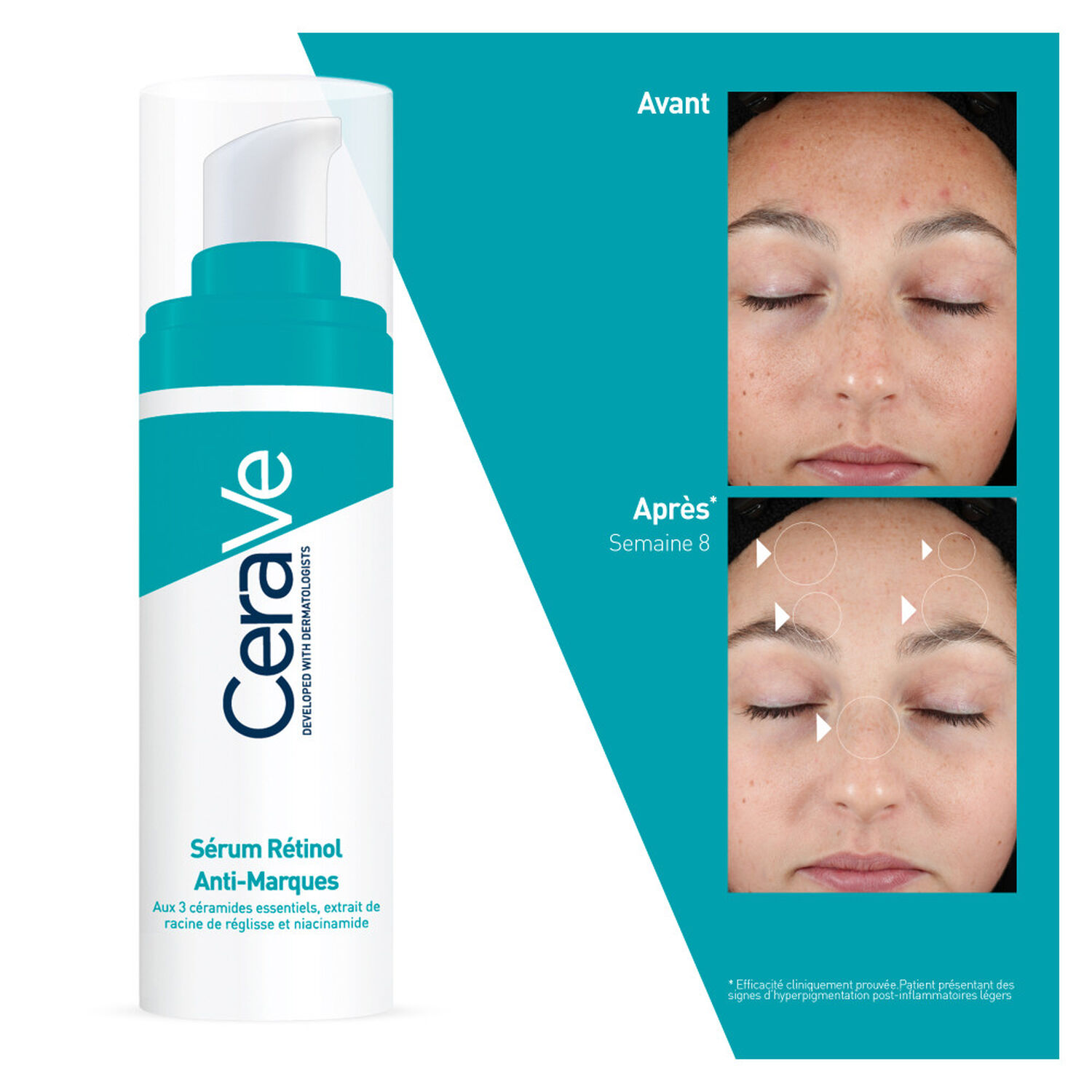 Cerave Rénitol Anti-Marques Sérum Réduisant L'Apparence des Marques 30 ml